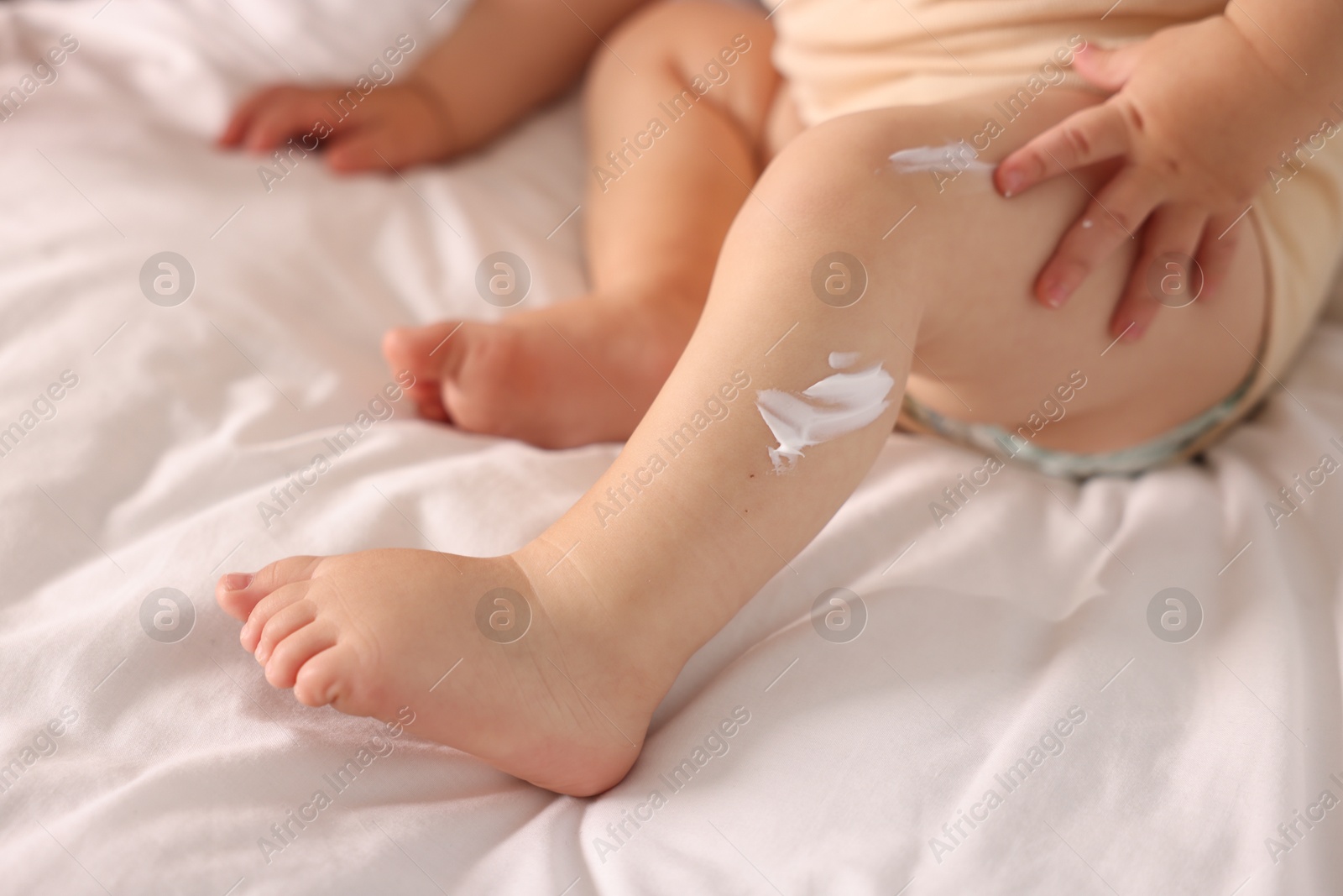 Photo of Cute baby with cream on his leg at home, closeup