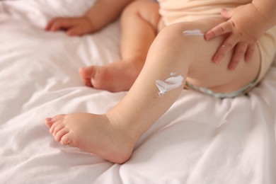 Photo of Cute baby with cream on his leg at home, closeup