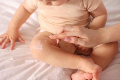 Photo of Mother applying cream onto her baby's leg on bed at home, closeup
