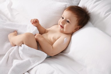 Photo of Cute little baby with cream on his body lying in bed