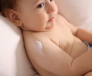 Photo of Cute little baby with cream on his body lying in bed, closeup