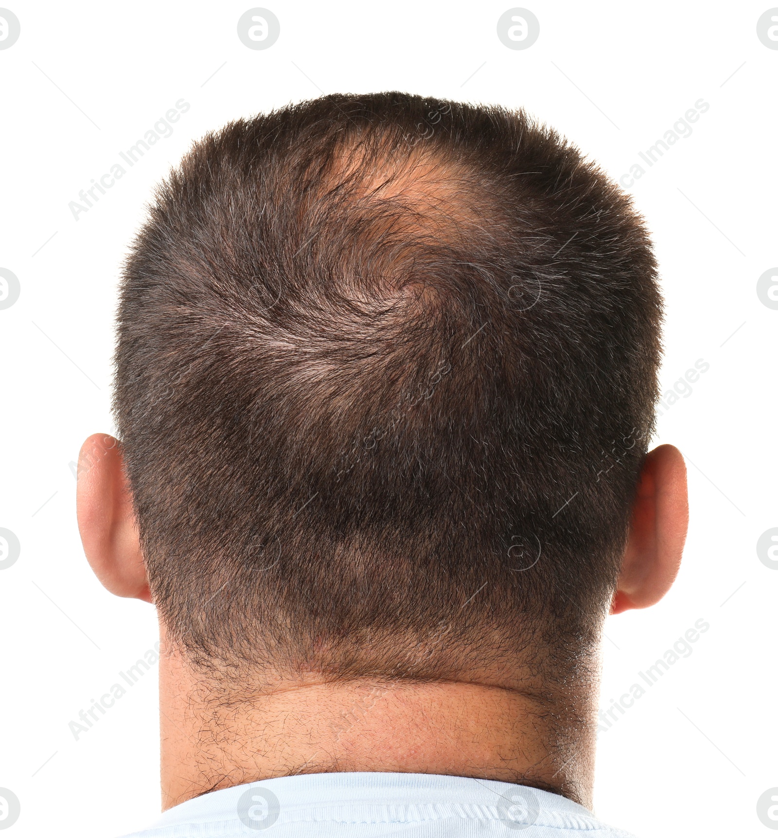 Photo of Man with bald spot on white background, back view