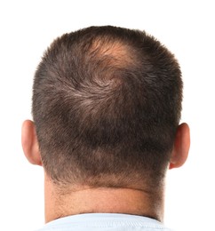 Photo of Man with bald spot on white background, back view