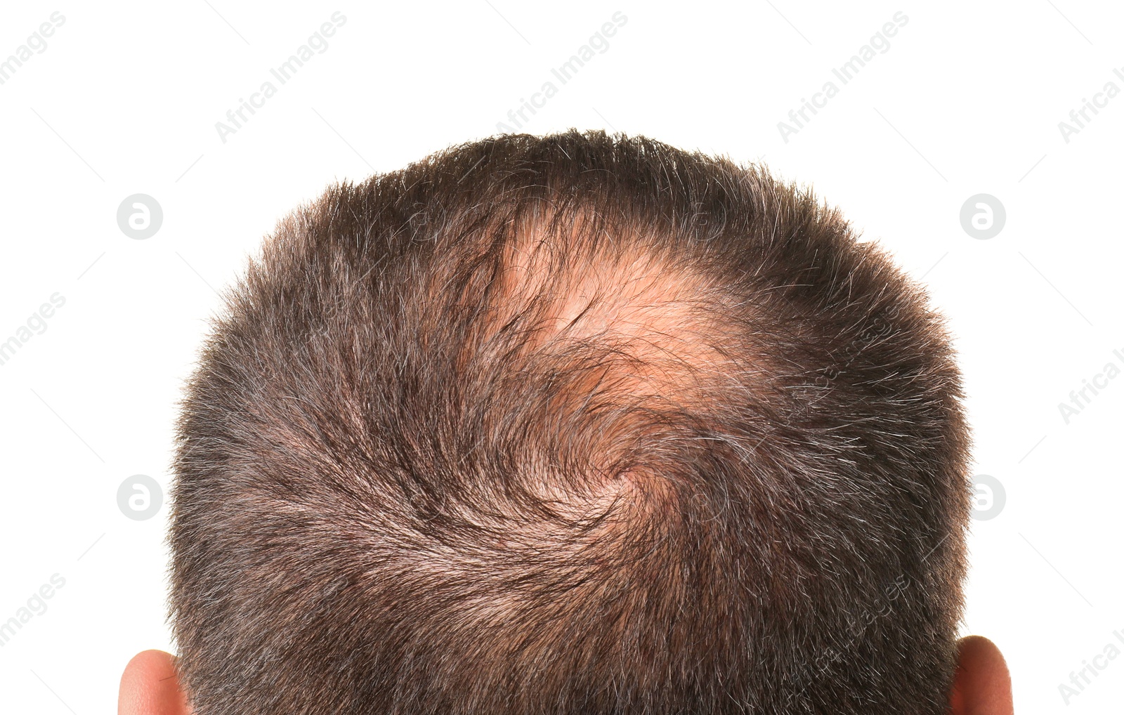 Photo of Man with bald spot on white background, back view