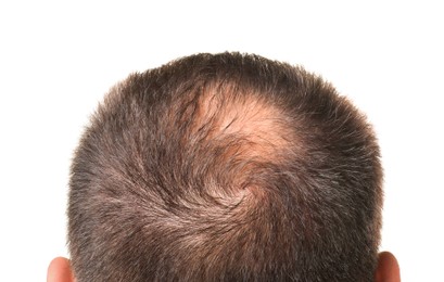 Photo of Man with bald spot on white background, back view