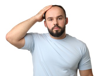 Photo of Baldness problem. Portrait of man with receding hairline on white background