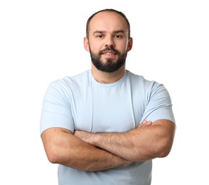 Photo of Baldness problem. Portrait of smiling man with receding hairline on white background