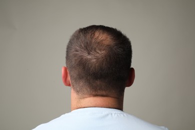 Photo of Man with bald spot on grey background, back view