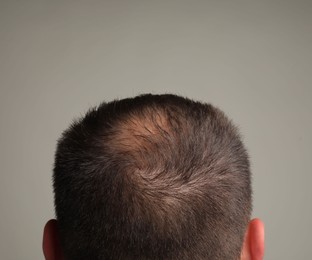 Photo of Man with bald spot on grey background, back view