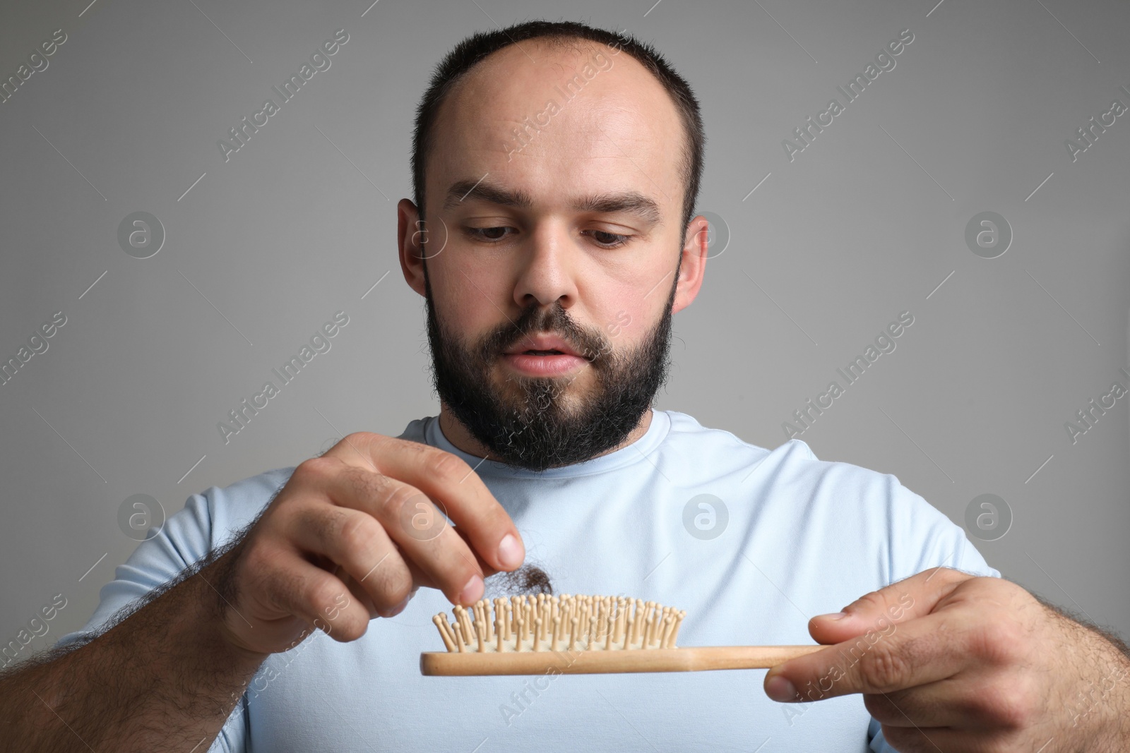 Photo of Baldness problem. Worried man with brush and clump of lost hair on grey background