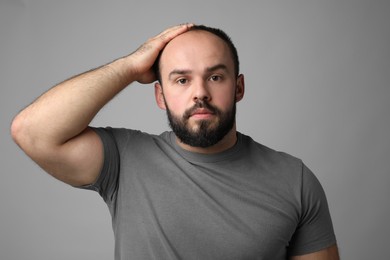 Photo of Baldness problem. Portrait of man with receding hairline on grey background