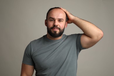 Photo of Baldness problem. Portrait of smiling man with receding hairline on grey background