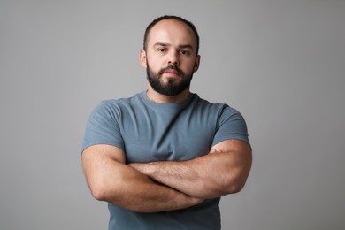 Photo of Baldness problem. Portrait of man with receding hairline on grey background