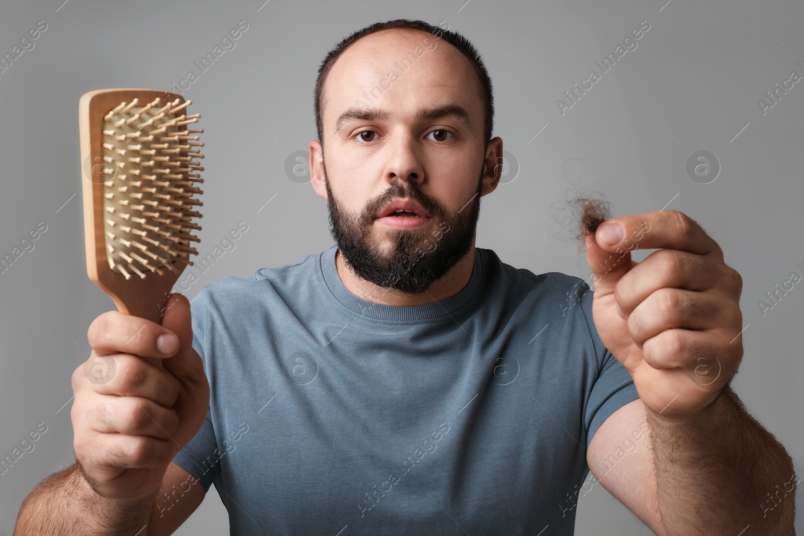 Photo of Baldness problem. Worried man with brush and clump of lost hair on grey background