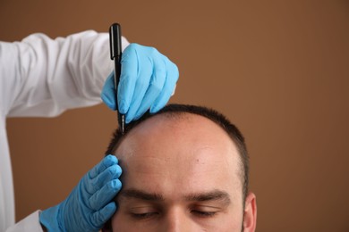 Photo of Baldness problem. Doctor in medical gloves drawing marks on patient's head before hair transplant surgery against brown background, closeup