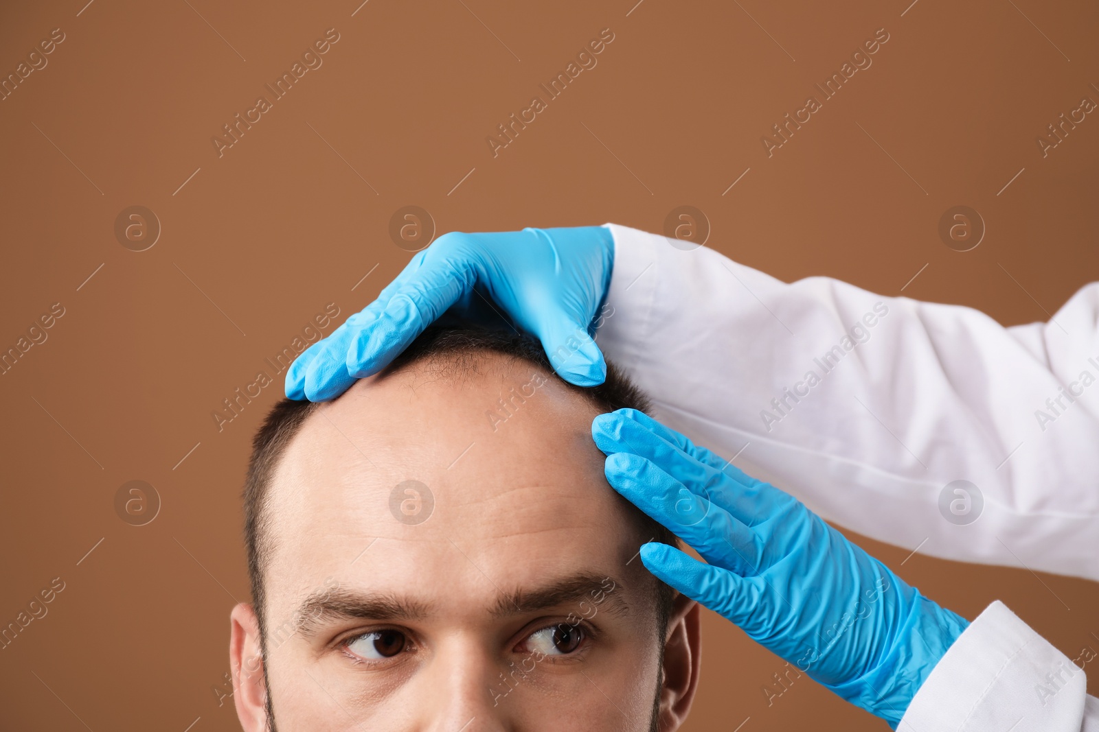 Photo of Baldness problem. Doctor in medical gloves examining patient's head against brown background, closeup