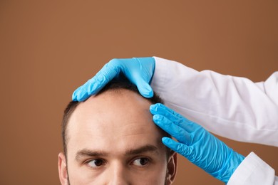 Photo of Baldness problem. Doctor in medical gloves examining patient's head against brown background, closeup