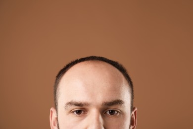 Photo of Baldness problem. Man with receding hairline on brown background, closeup. Space for text