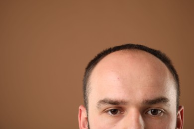 Photo of Baldness problem. Man with receding hairline on brown background, closeup. Space for text
