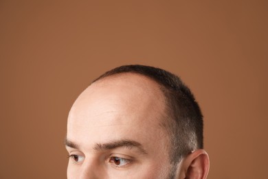 Photo of Baldness problem. Man with receding hairline on brown background, closeup