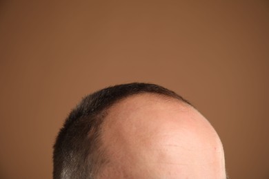 Photo of Baldness problem. Man with receding hairline on brown background, closeup. Space for text