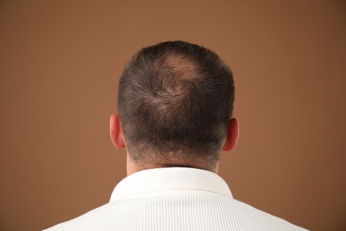 Photo of Man with bald spot on brown background, back view