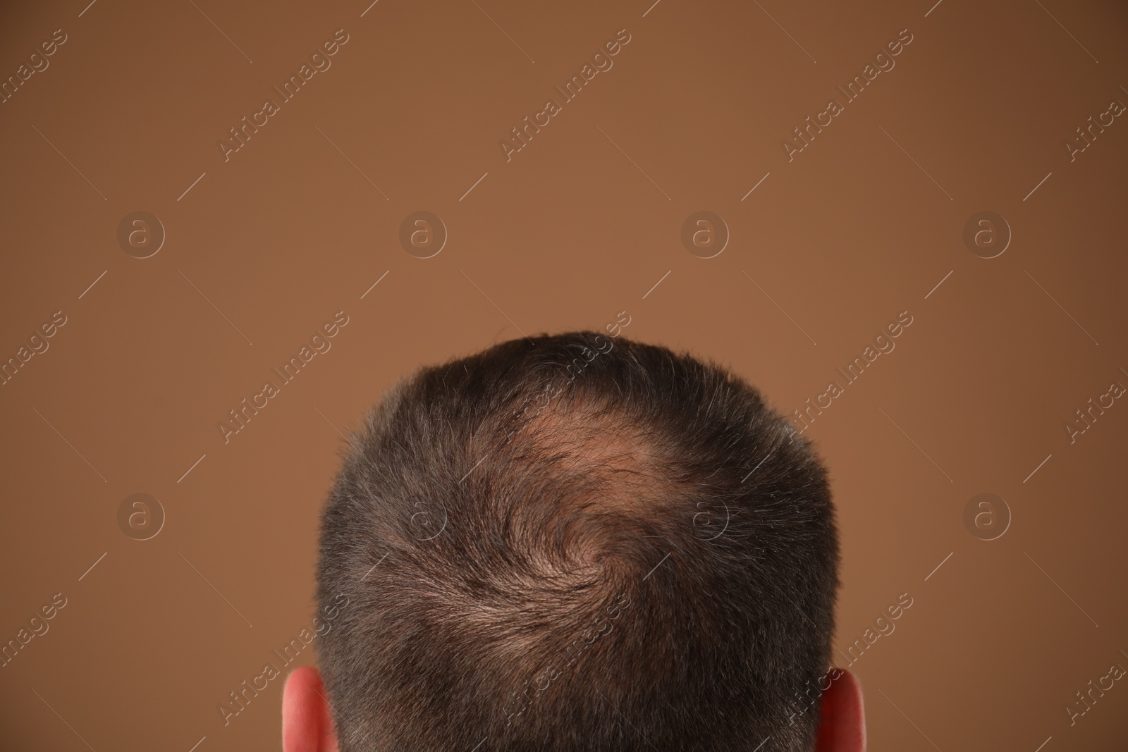 Photo of Man with bald spot on brown background, back view. Space for text