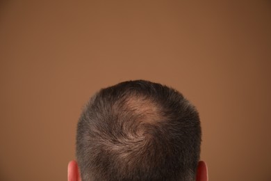 Photo of Man with bald spot on brown background, back view. Space for text