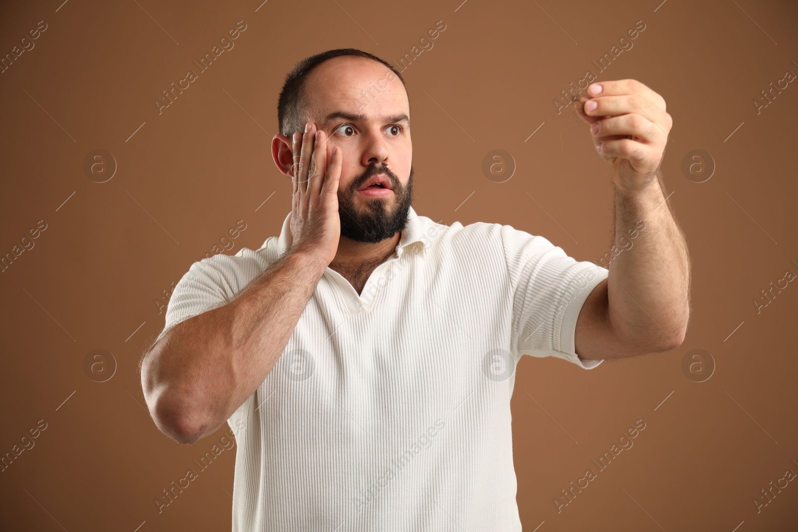 Photo of Baldness problem. Worried man with clump of lost hair on brown background
