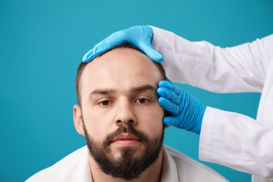 Photo of Baldness problem. Doctor in medical gloves examining patient's head against light blue background, closeup