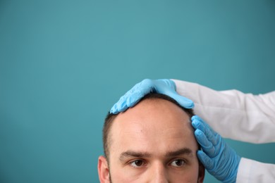 Photo of Baldness problem. Doctor in medical gloves examining patient's head against light blue background, closeup. Space for text