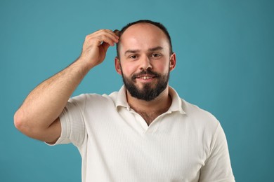 Photo of Baldness problem. Smiling man brushing his hair with comb on light blue background