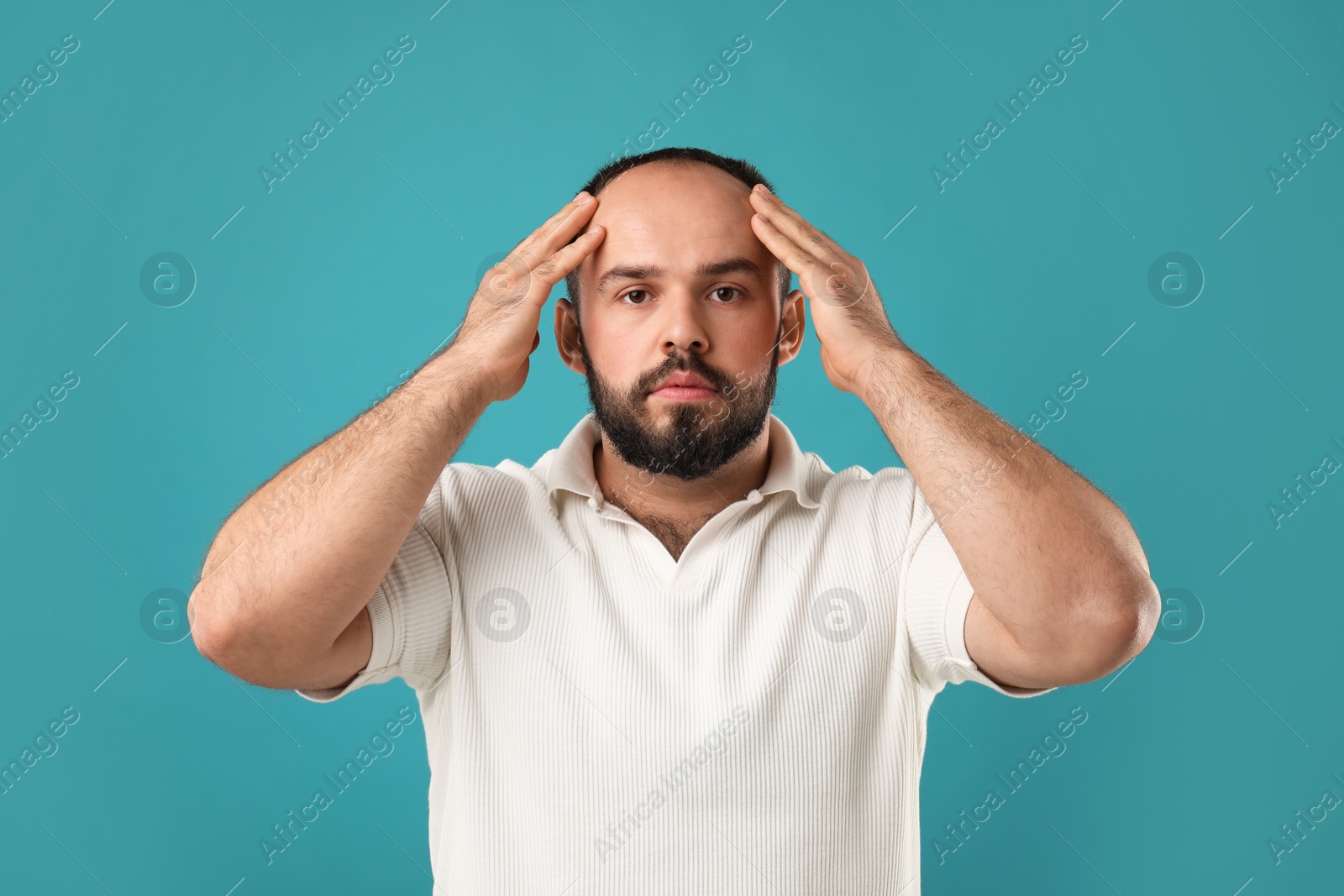 Photo of Baldness problem. Portrait of man with receding hairline on light blue background