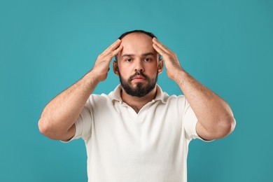 Photo of Baldness problem. Portrait of man with receding hairline on light blue background