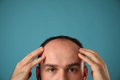 Photo of Baldness problem. Man with receding hairline on light blue background, closeup. Space for text