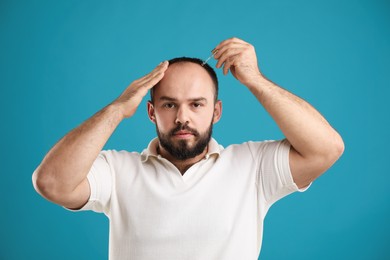 Photo of Baldness treatment. Man applying serum onto his hair on light blue background