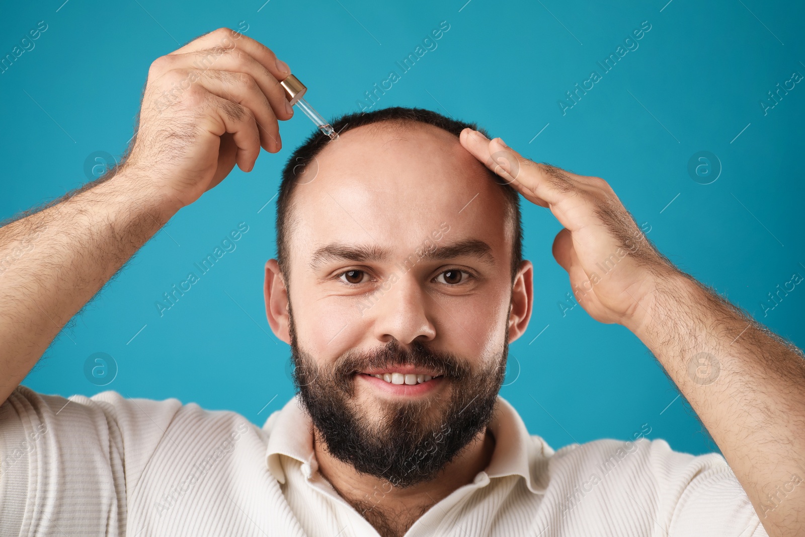 Photo of Baldness treatment. Smiling man applying serum onto his hair on light blue background