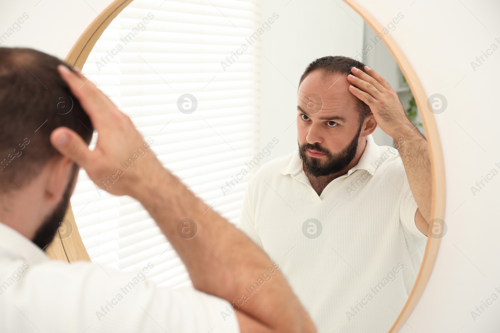 Photo of Baldness problem. Man with receding hairline near mirror at home