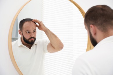 Photo of Baldness problem. Man with receding hairline near mirror at home