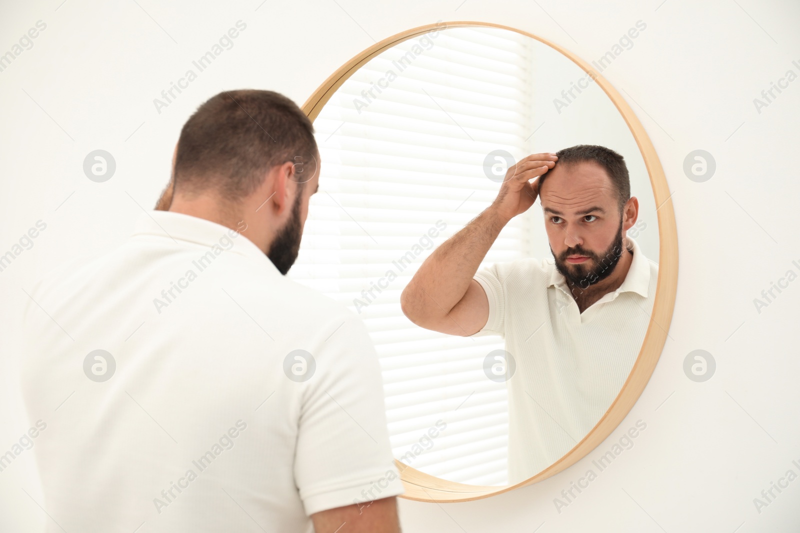 Photo of Baldness problem. Man with receding hairline near mirror at home