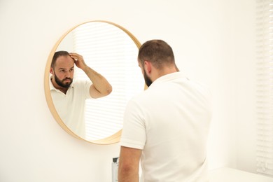 Photo of Baldness problem. Man with receding hairline near mirror at home