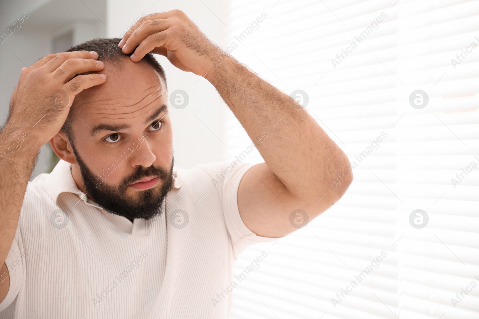 Photo of Baldness problem. Man with receding hairline near window at home. Space for text