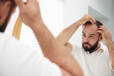Photo of Baldness problem. Man with receding hairline near mirror at home