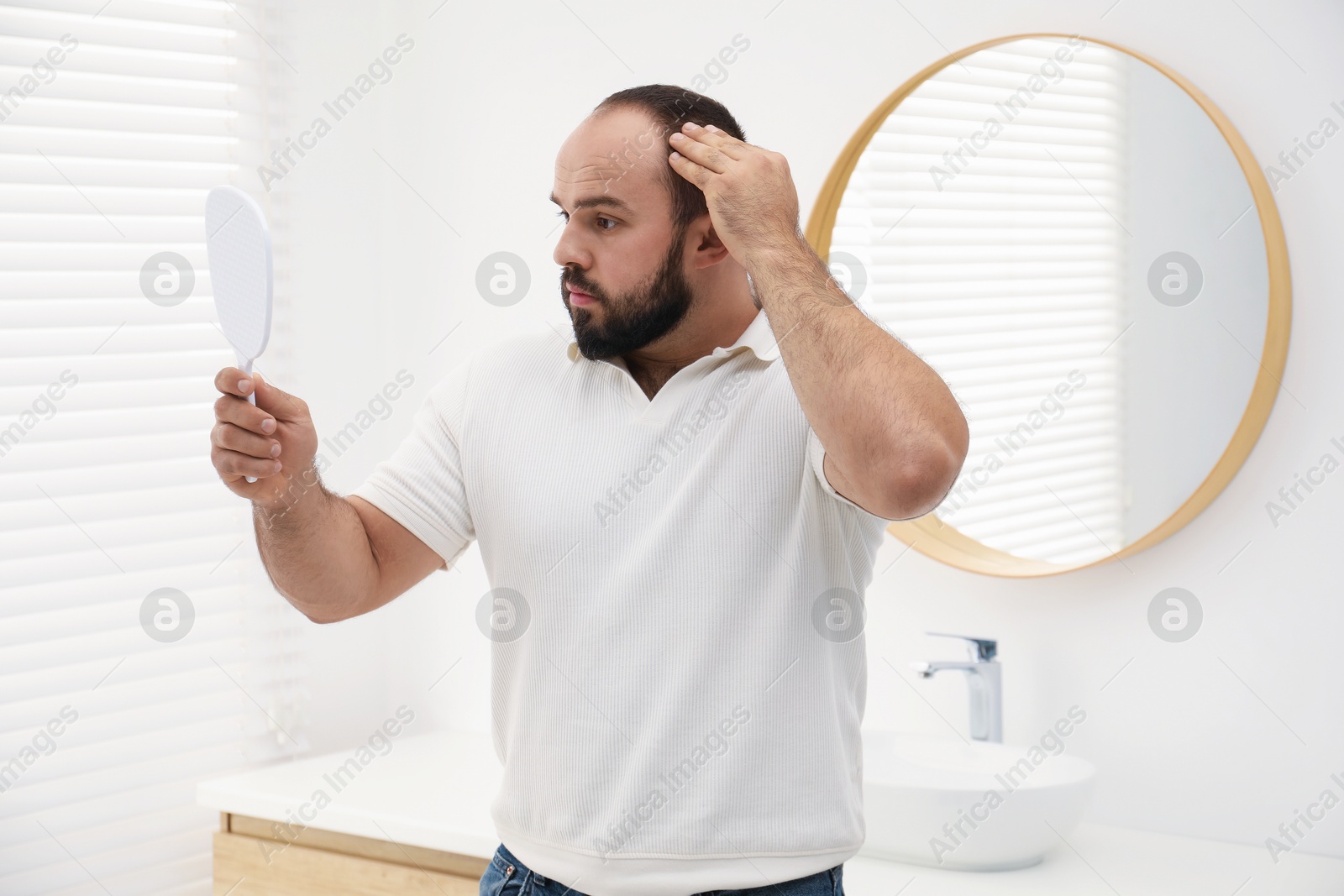 Photo of Baldness problem. Man with receding hairline looking at mirror indoors