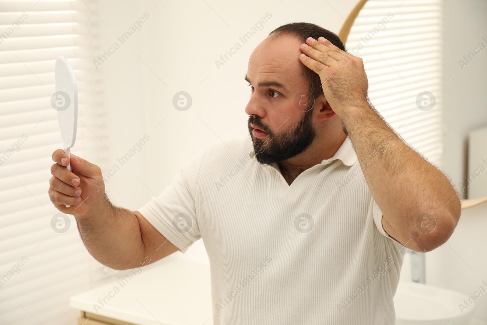 Photo of Baldness problem. Man with receding hairline looking at mirror indoors
