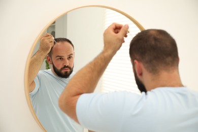 Photo of Baldness treatment. Man applying serum onto his hair near mirror at home