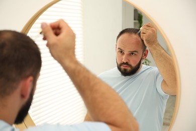 Photo of Baldness treatment. Man applying serum onto his hair near mirror at home