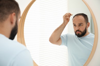 Photo of Baldness treatment. Man applying serum onto his hair near mirror at home