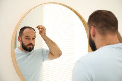 Photo of Baldness treatment. Man applying serum onto his hair near mirror at home