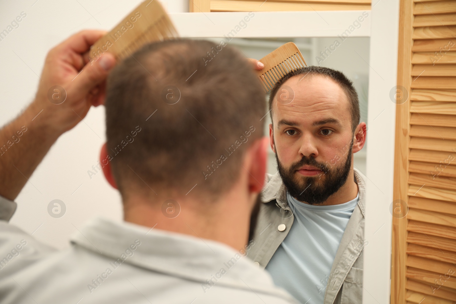 Photo of Baldness problem. Man brushing his hair with comb near mirror at home